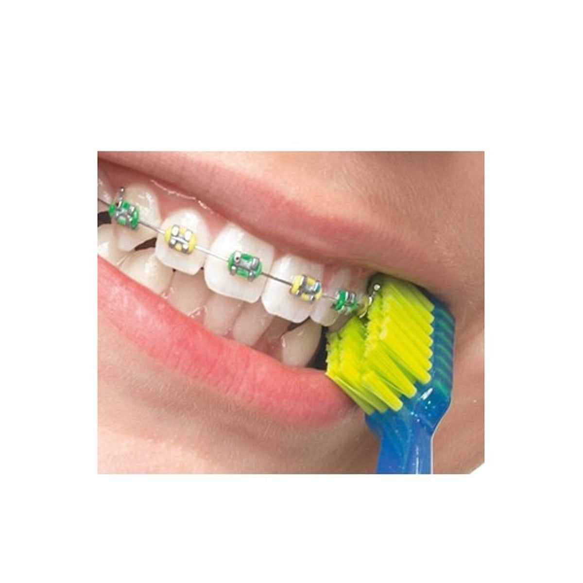 Curaprox CS Ortho Ultra Soft Toothbrush - Go Oral Care
