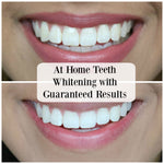 POLA Light At Home Teeth Whitening System - Go Oral Care